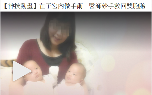 在子宮內做手術　醫師妙手救回雙胞胎